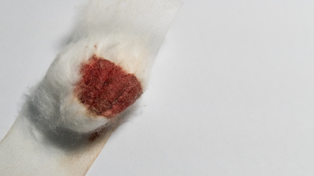human blood on cotton wool sponge ball on white background. Blood drawing or donating, medical service, health check up, hemostasis conceptの写真素材
