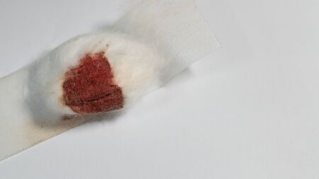 human blood on cotton wool sponge ball on white background. Blood drawing or donating, medical service, health check up, hemostasis conceptの写真素材