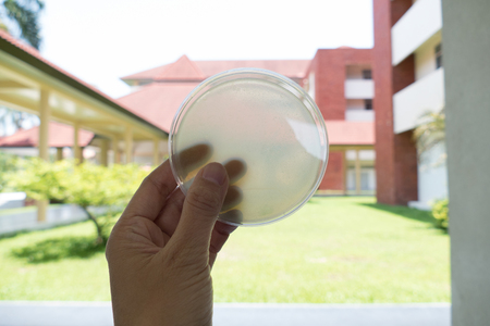hand holding agar medium in petri dish for microbial plate countの写真素材