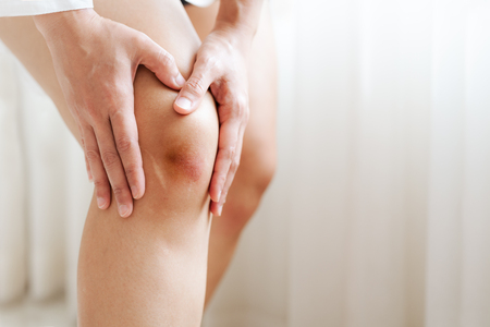 bruised knee of asia woman, selective focusの写真素材