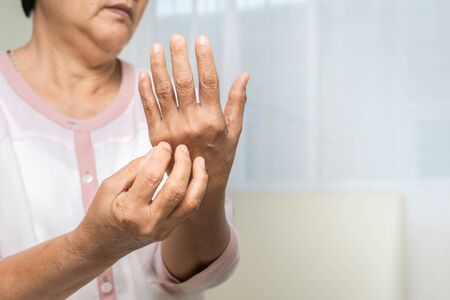 senior women scratch hand the itch on eczema arm, healthcare and medicine conceptの写真素材