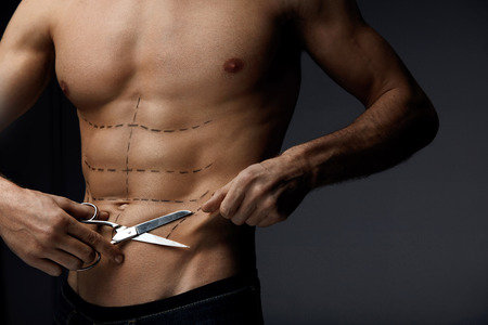Body Plastic Surgery Concept. Closeup Of Handsome Man With Naked Chest, Sexy Abs And Fit Torso Pulling His Skin, Holding Scissors In Hand. Male Body With Black Surgery Lines On Skin. High Resolutionの写真素材