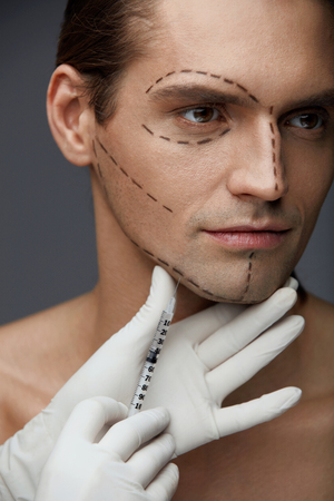 Plastic Surgery. Handsome Man With Lines On Face Receiving Skin Lifting Puncture, Filler Injection. Closeup Of Surgeon Hand Doing Facial Beauty Injections On Male Patient. Cosmetology. High Resolutionの写真素材