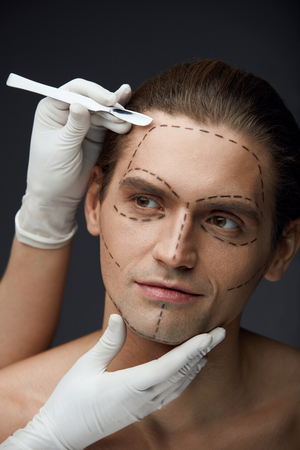 Cosmetic Operation. Portrait Of Young Man With Black Surgical Lines On Face Before Plastic Surgery. Closeup Of Doctor Hands With Scalpel Near Patient's Facial Skin. Beauty Treatment. High Resolutionの写真素材