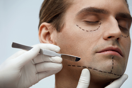 Plastic Surgery. Closeup Of Handsome Young Man With Black Lines On Facial Skin And Surgeon Hand With Scalpel Near Cutting Lines On Attractive Male Face Before Skin Lifting Operation. High Resolutionの写真素材