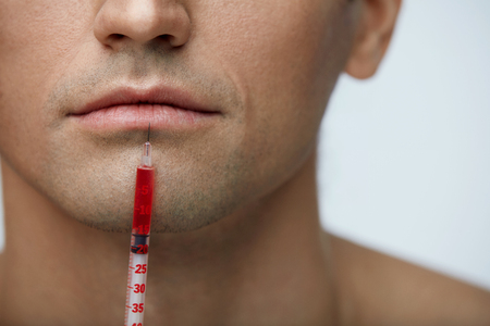 Facial Beauty. Closeup Of Handsome Man Face With Syringe With Red Liquid Near Lips. Male Patient Mouth Receiving Hyaluronic Collagen Injection Treatment. Lip Augmentation. High Resolutionの写真素材
