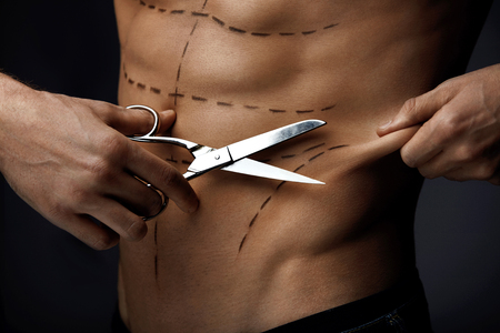 Body Plastic Surgery Concept. Closeup Of Handsome Man With Naked Chest, Sexy Abs And Fit Torso Pulling His Skin, Holding Scissors In Hand. Male Body With Black Surgery Lines On Skin. High Resolutionの写真素材