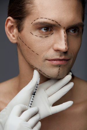 Plastic Surgery. Handsome Man With Lines On Face Receiving Skin Lifting Puncture, Filler Injection. Closeup Of Surgeon Hand Doing Facial Beauty Injections On Male Patient. Cosmetology. High Resolutionの写真素材