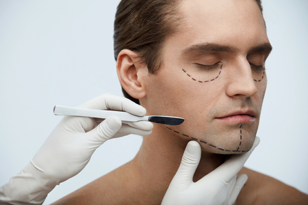 Plastic Surgery. Closeup Of Handsome Young Man With Black Lines On Facial Skin And Surgeon Hand With Scalpel Near Cutting Lines On Attractive Male Face Before Skin Lifting Operation. High Resolutionの写真素材