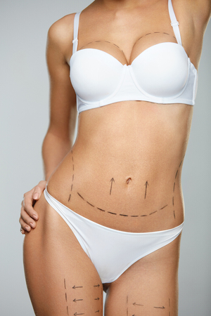 Woman Body Plastic Surgery Operation. Closeup Of Beautiful Sexy Female With Perfect Fit Body Shape And Black Surgical Lines On Skin In White Underwear On Grey Background. Cosmetology. High Resolutionの写真素材