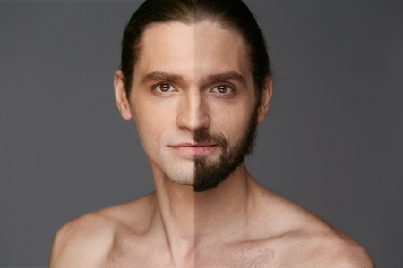 Shaving. Man With And Without Hair On Face  On Grey Background. High Resolution.の写真素材