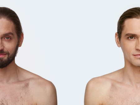 Man Face Before And After Shaving. Handsome Male With And Without Beard On White Background. High Resolution.の写真素材
