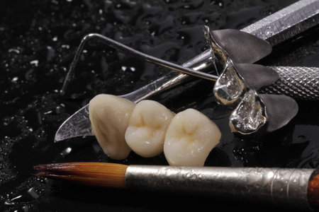 E-max pressed ceramic bridge and metal crown, dentistry utensils and mock-up