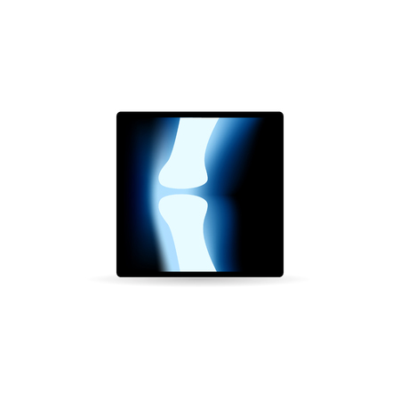 X-Ray image icon in color. Join skeleton footのイラスト素材