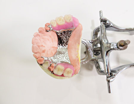 maxillary parial wax dentureの写真素材