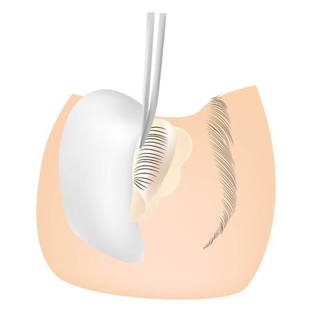 Woman on the procedure for eyelash extensions, eyelashes laminationのイラスト素材