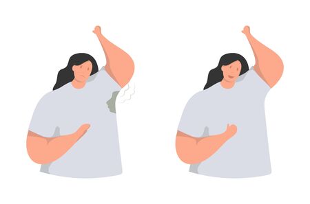 Vector flat isolated illustration of woman with and without hyperhidrosis. Medical, pharmaceutical and cosmetic concept. web design, various printing and other products can be used.のイラスト素材