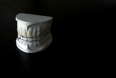 dental model of human teeth  white teethの写真素材