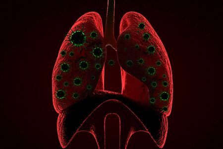 Medical 3d illustration infected with Coronavirus COVID-19, a respiratory cell virus influenza virus in China.の写真素材