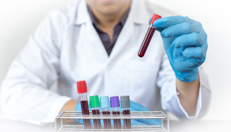 Scientists or doctors collect blood samples from new strains of virus patients for analysis and vaccination in the research laboratory, Vaccine research to eliminate viruses concept.の写真素材
