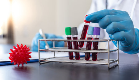 Scientists or physicians analyze the blood sample in vitro to prepare a vaccine against a new strain of viruses, Vaccine Research and Science concept.の写真素材