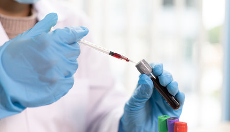 Scientists are testing antiretroviral drugs from the blood of infected patients in order to analyze antibiotics for normal treatment, Testing antiretroviral drugs or pathogens concept.の写真素材