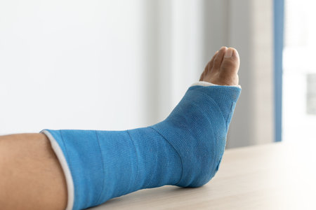 Blue ankle and foot splint Bandages on the legs from a young man's fall accident, Blue plaster on the ankle.の写真素材