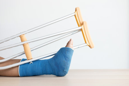 Blue ankle and foot splint Bandages on the legs from a young man's fall accident, Blue plaster on the ankle, Crutches assist in the walking of the patient.の写真素材