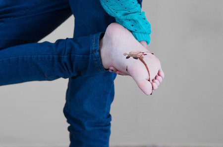 closeup of young girl bleeding on the sole of her footの写真素材