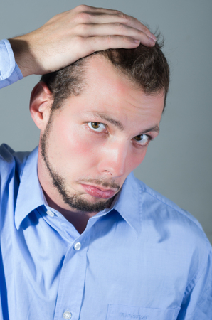 Handsome concerned young man worried about hair lossの写真素材
