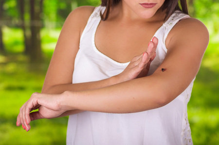 Close up of a young woman using her hand to kill a mosquito over her arm, in a blurred green backgroundの写真素材