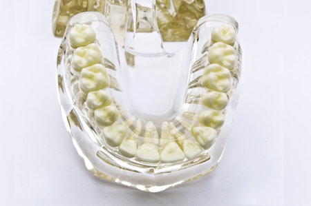 Transparent dental model on white background