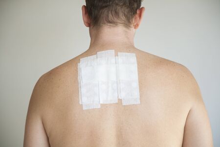 bare man back with contact allergy test in white adhesive plasterの写真素材