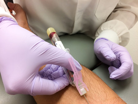 Arm needle syringe blood test sample draw procedure series with latex glove