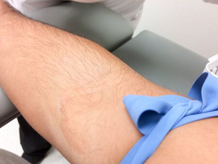 Arm needle syringe blood test sample draw procedure series with latex gloveの写真素材