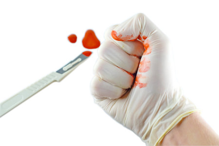 The scalpel in blood and hands of the doctor, isolated
