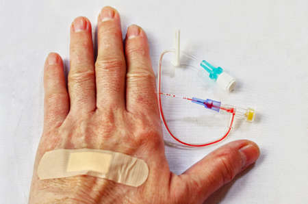 Hand that take off i.v. catheter and attach the plaster.の写真素材