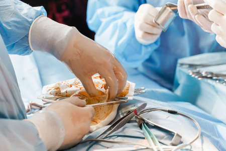 Surgeon with headlamp and scissors do plastic operation in medical clinic. Chest augmentation plastic operation and correction in medical clinicの写真素材