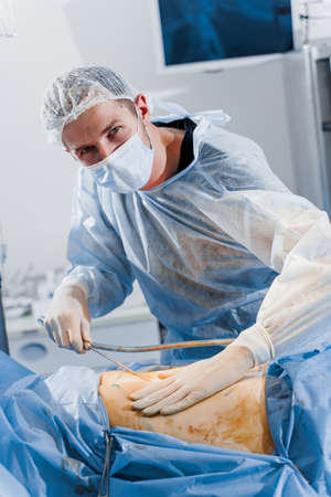 Abdominoplasty - plastic operation to reduce the abdomen and remove cellulite. Correcting body shape. Surgeon does liposuction for patient in medical clinicの写真素材