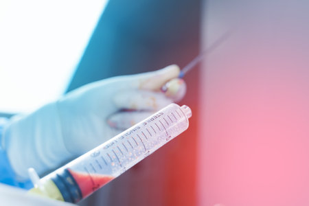 Human fat in a syringe close-up. Liposuction for lipofilling surgery operation. Plastic operation in...