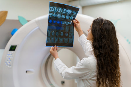 Young caucasian girl doctor looks at x-ray picture of patient brain near kt komputer tomograhphy. Young girl in medical clinic gotes new expirienceの写真素材