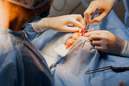 Blepharoplasty plastic surgery operation for modifying the eye region of the face in medical clinic. 2 doctors do plastic cosmetic operation for woman. Surgeon makes an incision with a surgical knifeの写真素材
