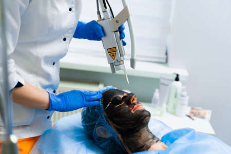 Laser photorejuvenation and carbon peeling of face for woman. Black face mask. Dermatology and...