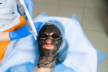 Laser photorejuvenation and carbon peeling of face for woman. Black face mask. Dermatology and cosmetology. Using surgical laser.の写真素材