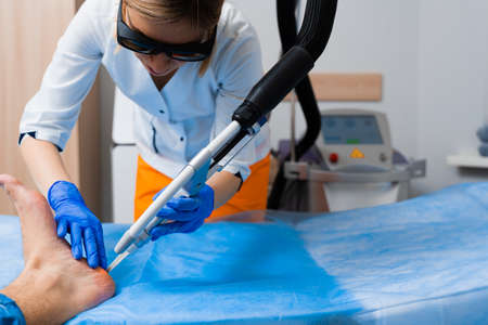 Laser removal of warts on the foot. Medical dermatological surgery in the clinic.の写真素材