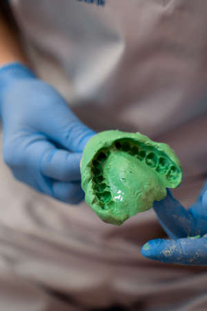 Dental cast of jaws. Dentist does his job in stomatology clinic