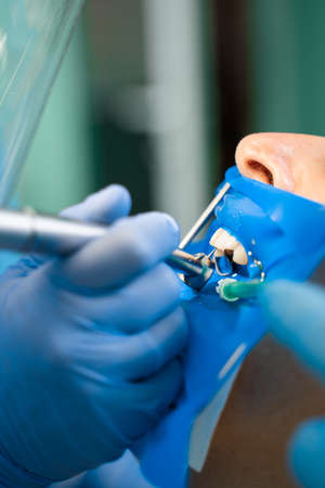 Dental treatment cofferdam in stomatology. Dentist using dental dam for tooth isolation
