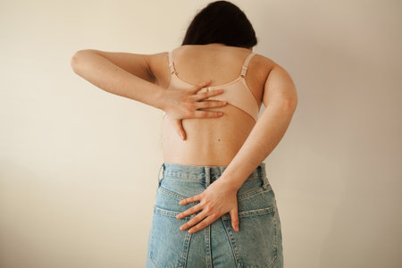 Rachiocampsis bachache of woman. Scoliosis is sideways curvature of the spine. Rheumatism and arthritis diseasesの写真素材
