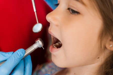 Dental drill close-up. Child dentist drilling teeth of kid girl in dentistry clinic. Teeth...