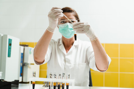 Analysis of blood plasma. The laboratory assistant holds a test tube with blood from a vein in his hands and looks at it. Blood test in the laboratory. Medical scientist with glasses and maskの写真素材